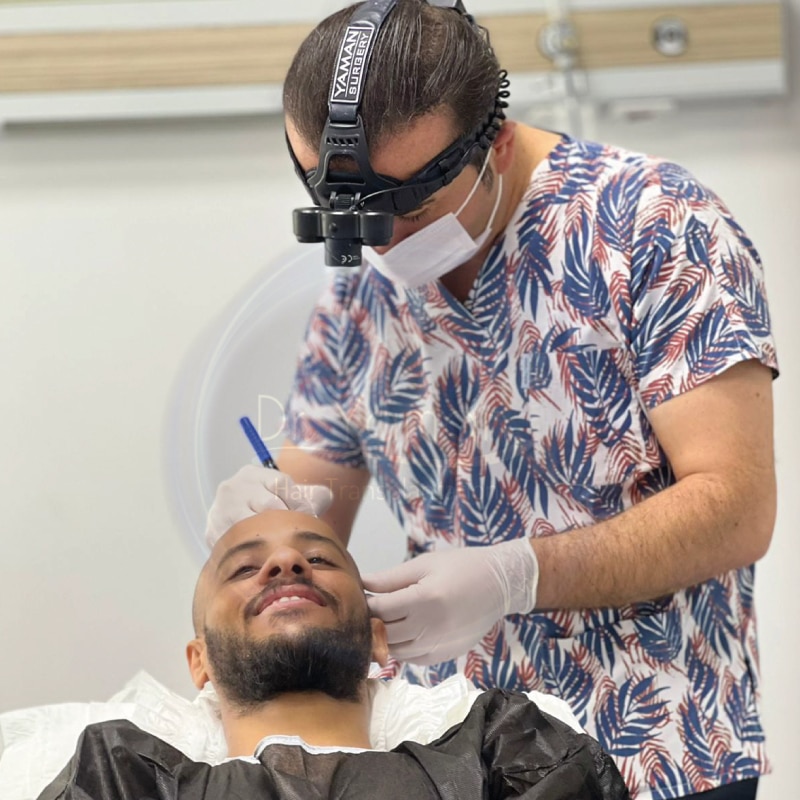 Dr. Resul Yaman Hair Transplant Journey