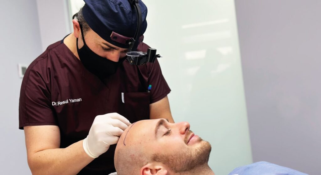 hair transplant in Turkey