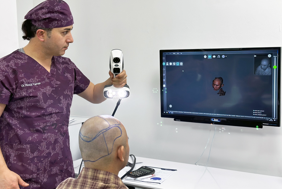 3SE DHI Implantation