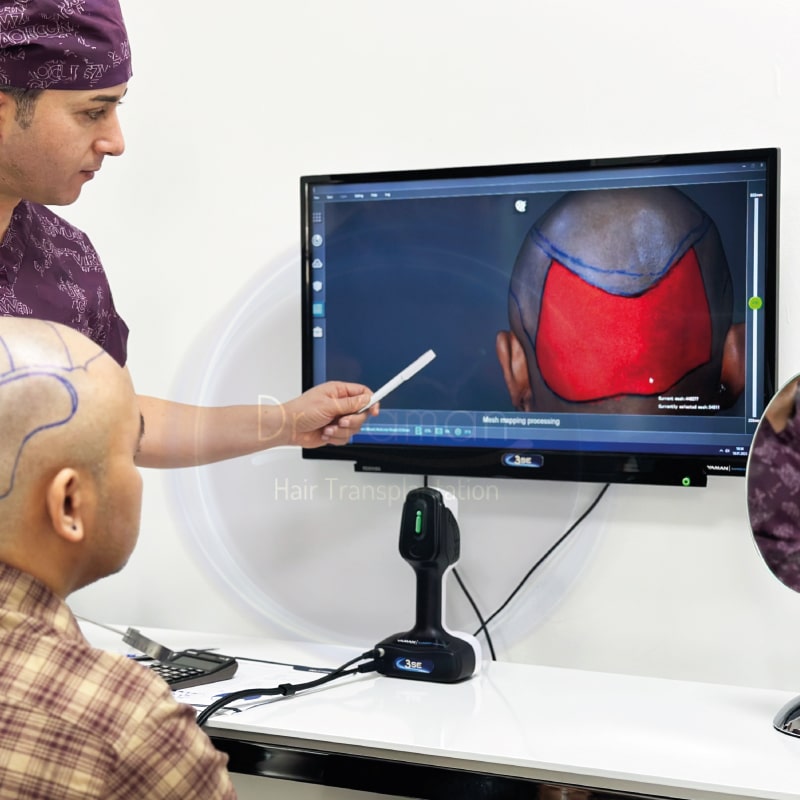 turkey hair transplant