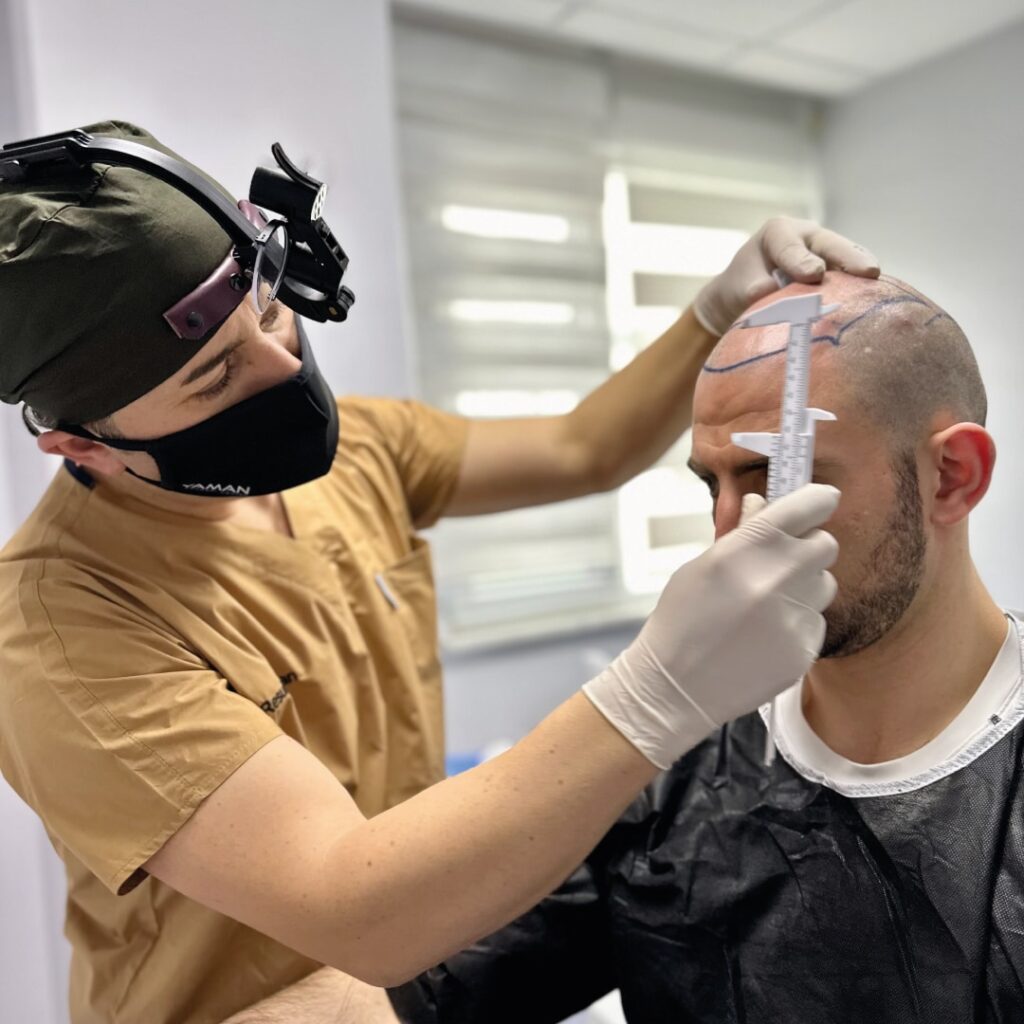 Do Hair Transplant Costs Vary Based on the Extent of Hair Loss or Desired Results