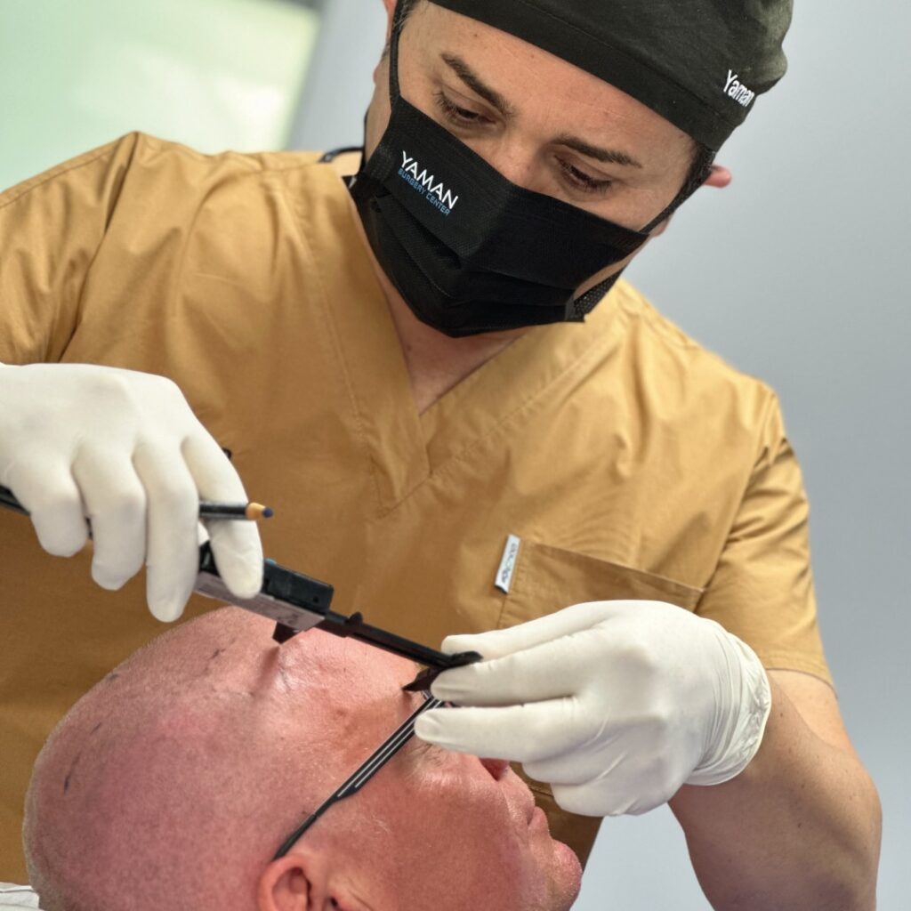 Does Transplanted Hair Turn Gray