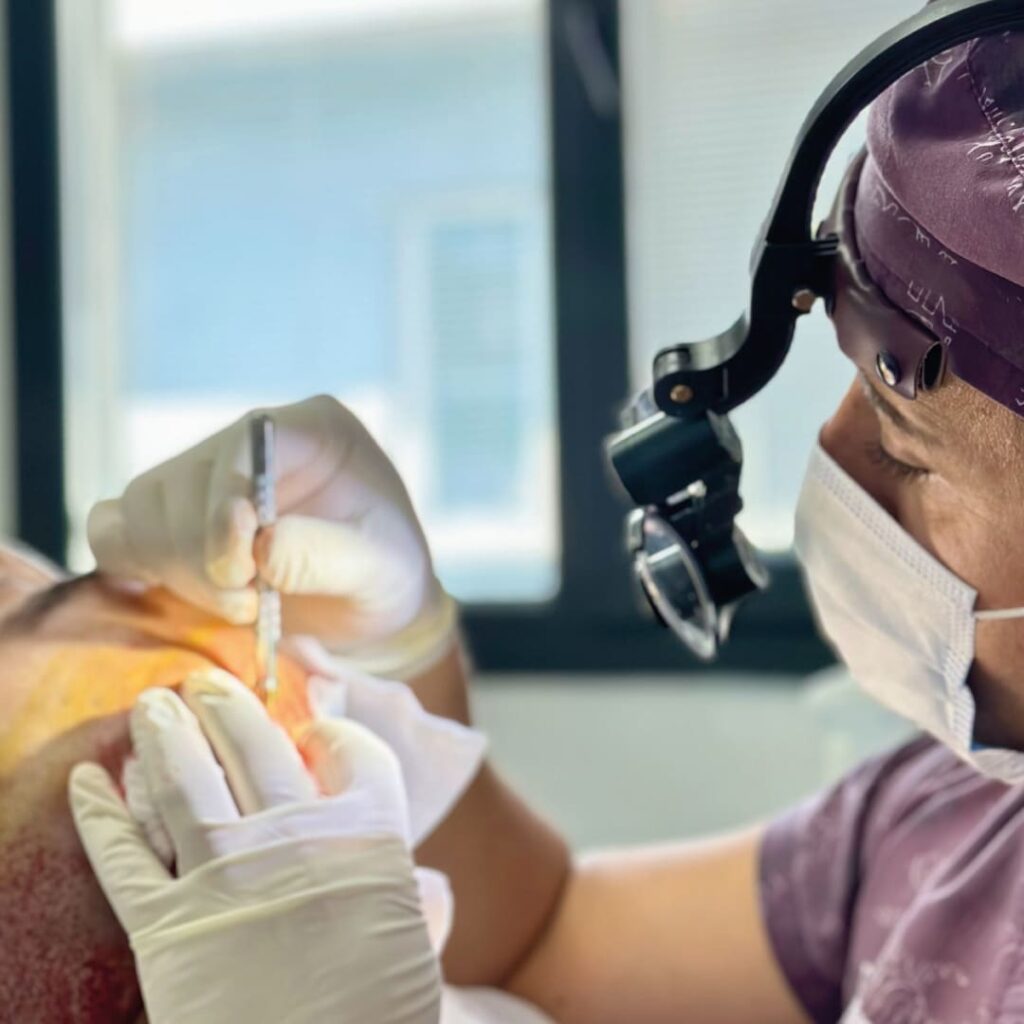 DHI Hair Transplant Turkey Reviews