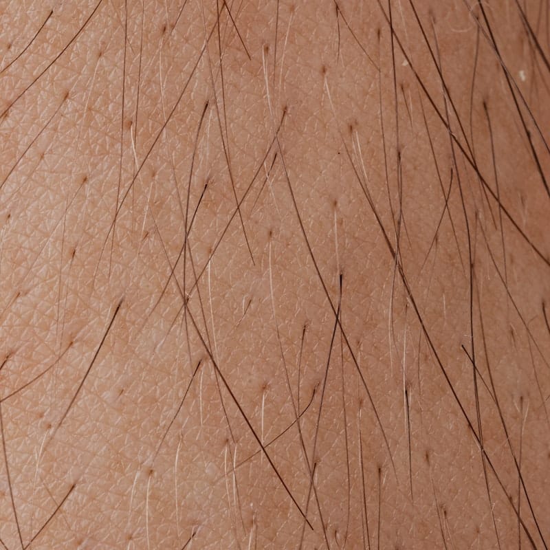 Can You Change Your Hair Type With Surgery