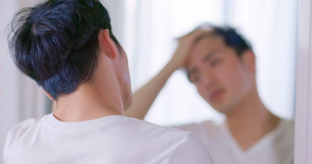 man with hair loss looking in the mirror