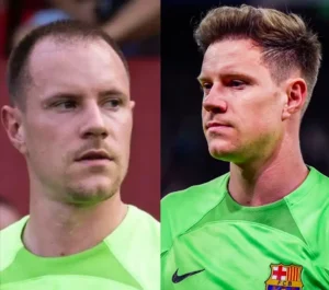 Ter Stegen Hair Transplant