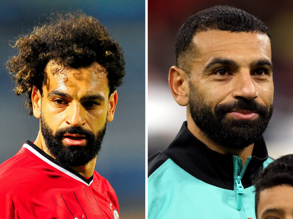 Mo Salah Hair Transplant