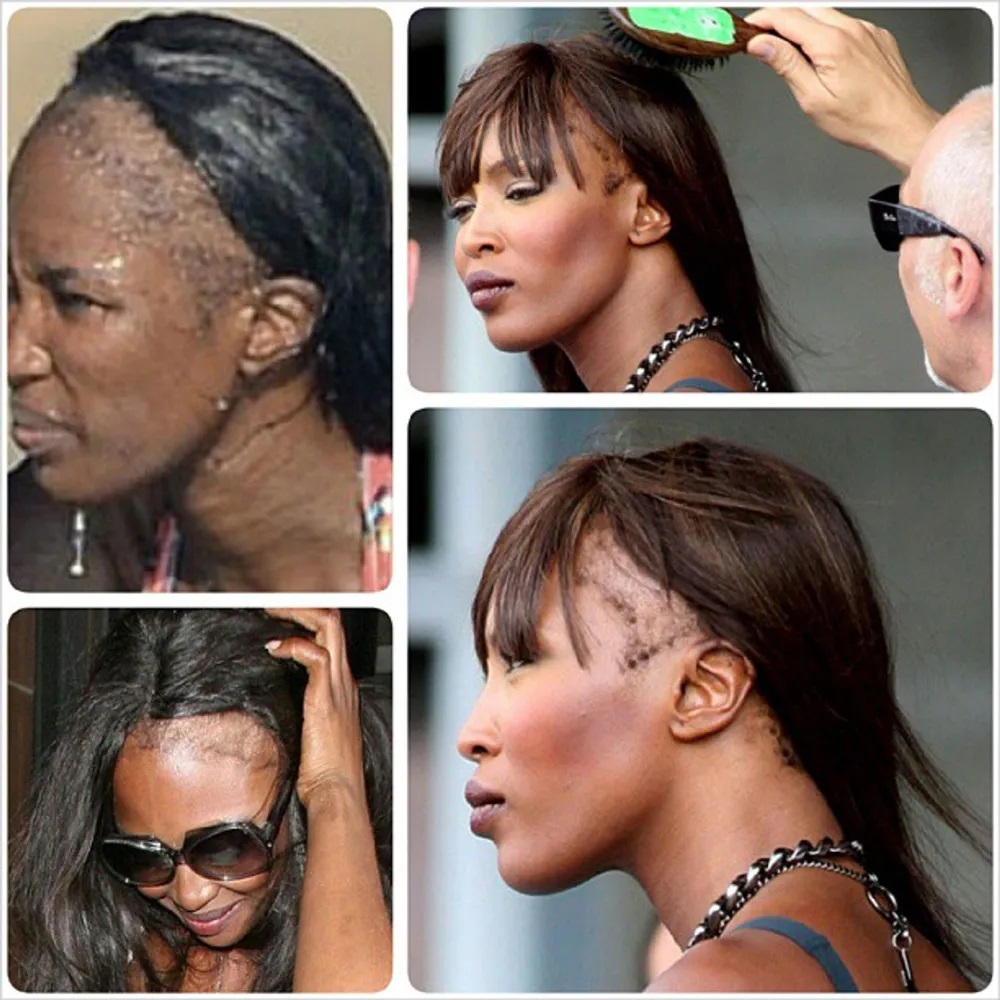 Naomi Campbell Hair Loss