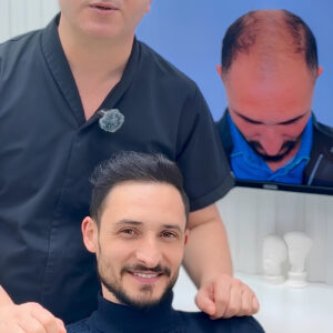 Achieve Natural Hair Transplant Results