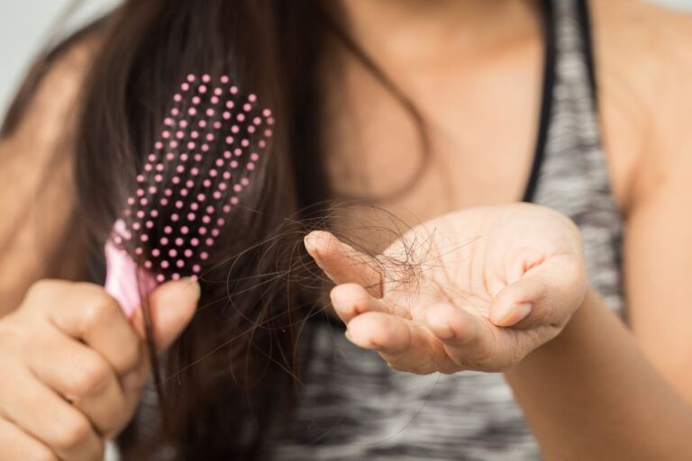 Anorexia and Hair Loss