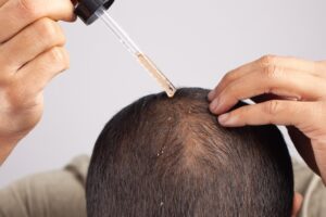 Does Hair Growth Serum Work