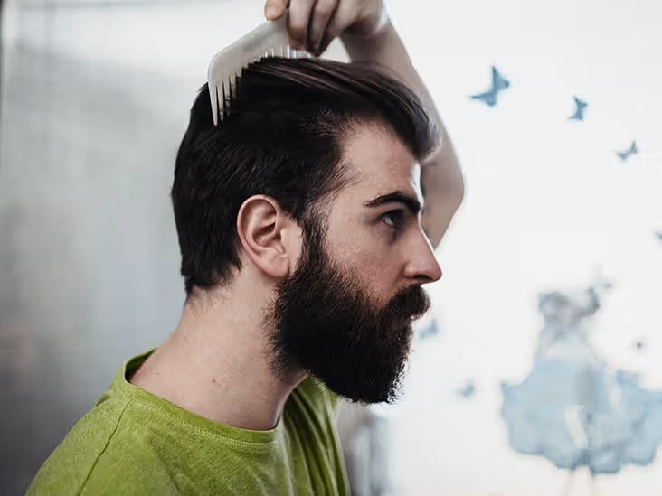 Do Steroids Cause Hair Loss?