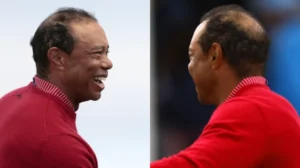 Tiger Woods Hair Transplant Journey